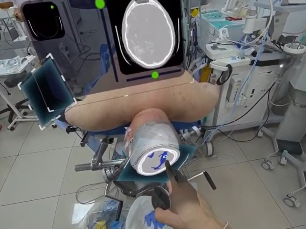 Surgical AR for Intraoperative navigation